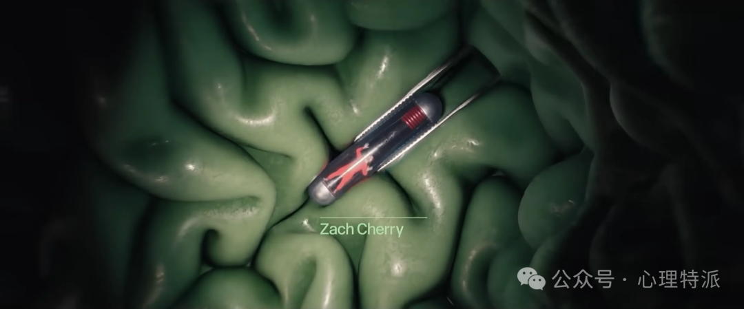 人生切割术_切割手术是什么意思_切割术失败